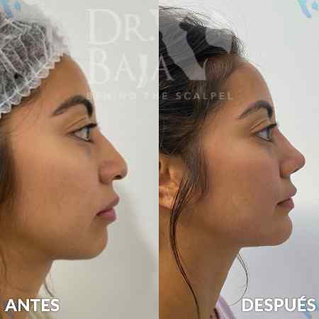 Perfil-1