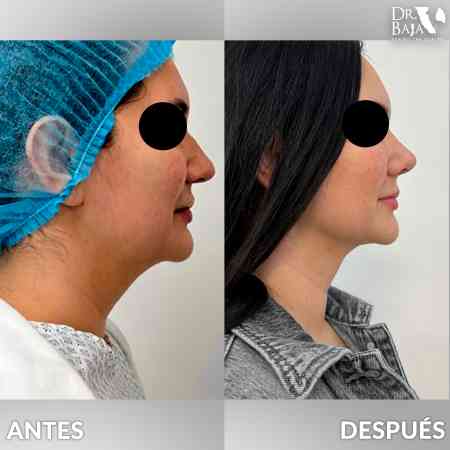 Perfil-6