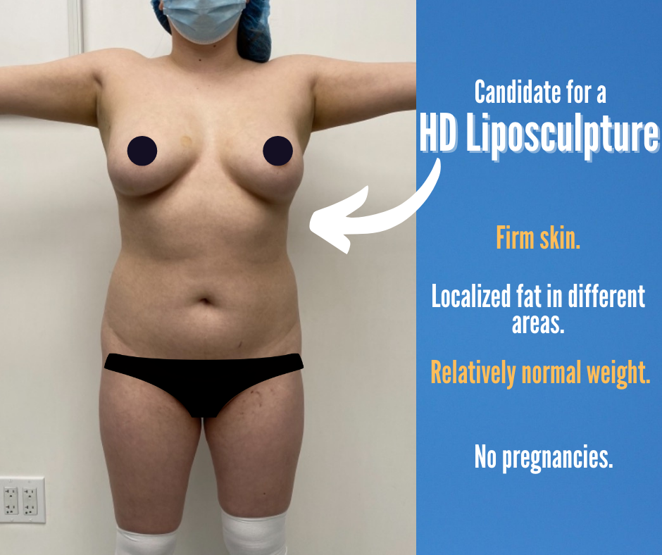 HD Lipo