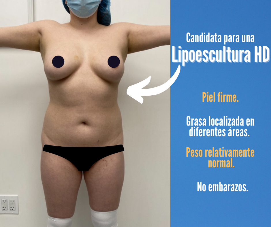 Candidata para una Lipoescultura HD